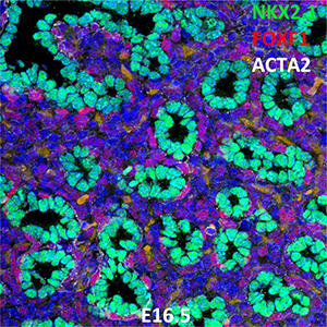 E16.5 C57BL6 NKX2.1, FOXF1, and ACTA2 Confocal Imaging
