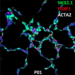 Postnatal Day 01 C57BL6 NKX2.1, FOXF1, and ACTA2 Confocal Imaging