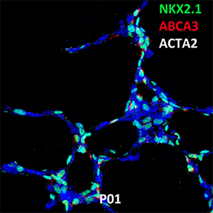 PND01 NKX2.1, ABCA3, and ACTA2 Confocal Imaging