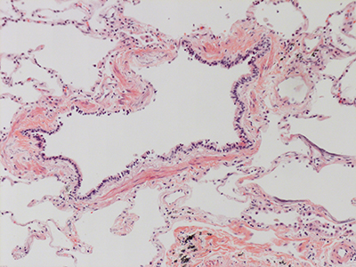 H&E Staining of 31 Year Old Human Lung D0036.04HP-#5-01