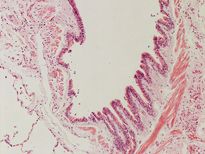 H&E Staining of 31 Year Old Human Lung D0036.04HP_2_14