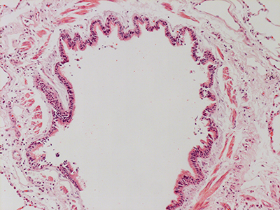 H&E Staining of 31 Year Old Human Lung D0036.04HP_2_1