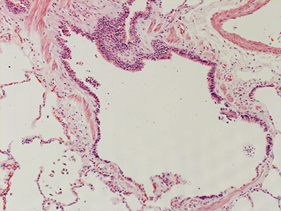 H&E Staining of 31 Year Old Human Lung D0036.04HP_2_31