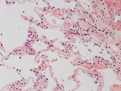 H&E Staining of 31 Year Old Human Lung D0036.04HP-#5-22
