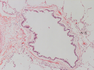 H&E Staining 31 Year Old Human Lung DD036L_MC15_04H_6_10