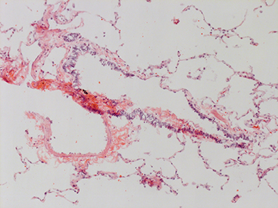 H&E Staining 31 Year Old Human Lung DD034L_MC15_03H_4_11