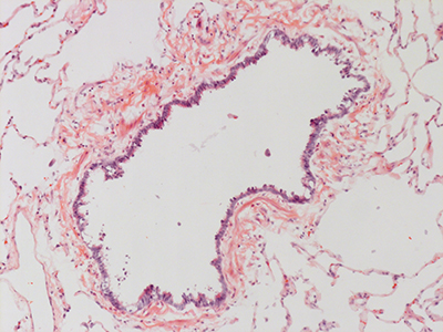 H&E Staining 31 Year Old Human Lung DD034L_MC15_03H_4_21