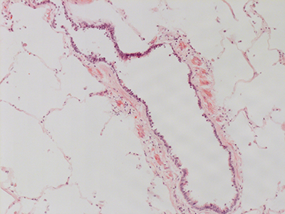 H&E Staining 31 Year Old Human Lung DD036L_MC15_04H_6_11