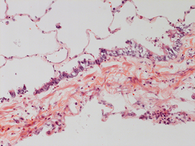 H&E Staining 31 Year Old Human Lung DD034L_MC15_03H_4_10