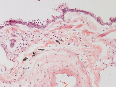 H&E Staining 31 Year Old Human Lung DD036L_MC15_04H_6_21