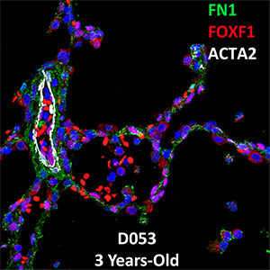 3 Year-Old Human Lung Confocal Imaging Donor D053 FN1, FOXF1, and ACTA2