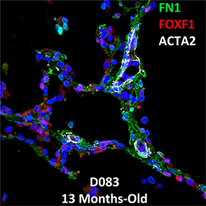 13 Month-Old Human Lung Confocal Imaging Donor D083 FN1, FOXF1, and ACTA2