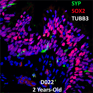 2 Year-Old Human Lung Confocal Imaging Donor D022 SYP, SOX2, and TUBB3
