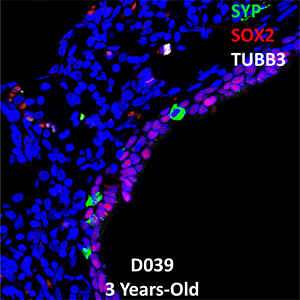 3 Year-Old Human Lung Confocal Imaging Donor D039 SYP, SOX2, and TUBB3