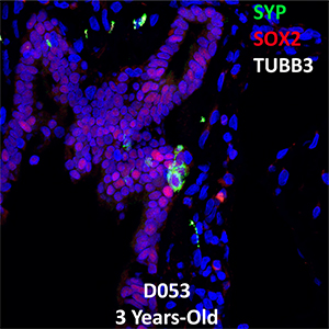 3 Year-Old Human Lung Confocal Imaging Donor D053 SYP, SOX2, and TUBB3