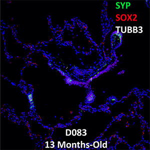 13 Month-Old Human Lung Confocal Imaging Donor D083 SYP, SOX2, and TUBB3