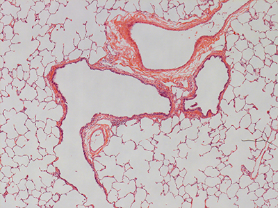 H&E Staining of a 3 Year-Old Human Lung D032-RLL-4A2-FFPE