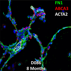 8 Month-Old Human Lung Immunofluorescence and Confocal Imaging Donor D086 Showing Expressions of FN1, ABCA3, and ACTA2