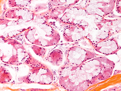 H&E Staining of 2 Year-Old Human Lung from Donor CCHMC-D007-B29.3