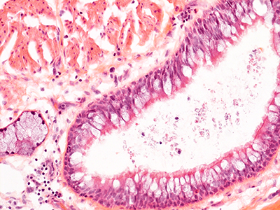 H&E Staining of 31 Year-Old Human Lung from Donor CCHMC-D003-A21.12